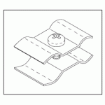 CHATTANOOGA REPLACEMENT BRACKET (BULB SUPPORT)